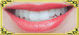 前歯の審美歯科