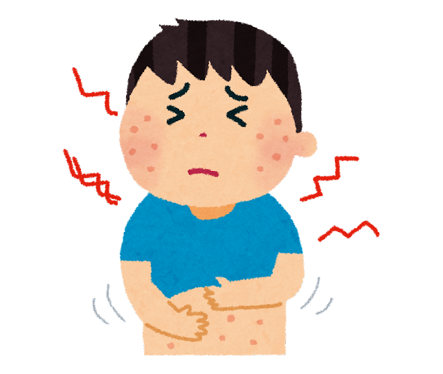 帯状疱疹予防
